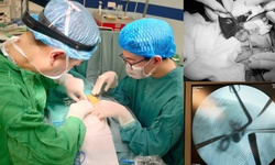 B&#233; 1 th&#225;ng tuổi mắc bệnh hiếm 10.000 trẻ sinh ra mới c&#243; 1 trẻ bị