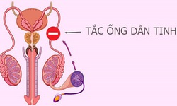 C&#225;c c&#226;u hỏi thường gặp về bệnh vi&#234;m tắc ống dẫn tinh