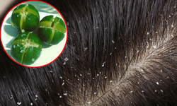 5 c&#225;ch để hết g&#224;u nhanh ch&#243;ng
