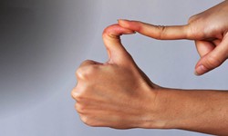 Hội chứng ehlers-danlos: Nguy&#234;n nh&#226;n, biểu hiện, c&#225;ch điều trị v&#224; ph&#242;ng bệnh