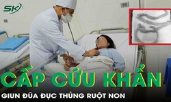 Giun đũa đục thủng ruột non, người phụ nữ phải cấp cứu khẩn
