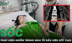 B&#224;ng ho&#224;ng ph&#225;t hiện nhiễm tr&#249;ng m&#225;u từ dấu hiệu sốt v&#224;o chiều tối 
