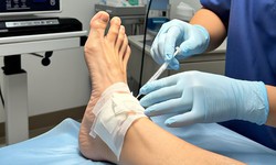 C&#225;c thuốc d&#249;ng trị Hội chứng ống cổ ch&#226;n