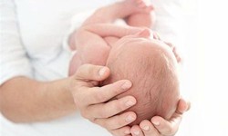 C&#226;u hỏi thường gặp li&#234;n quan đến hội chứng Crouzon