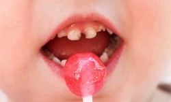 Răng sữa: Tạm thời hay &#39;nền tảng quan trọng&#39; m&#224; mẹ chưa biết?