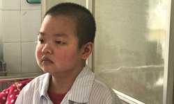 C&#226;u hỏi thường gặp về lupus ban đỏ