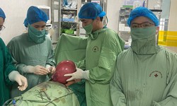 Chủ quan nghĩ b&#233;o bụng, người phụ nữ mang trong m&#236;nh khối u tử cung to như quả b&#243;ng