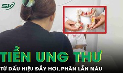 Tưởng rối loạn ti&#234;u h&#243;a, người phụ nữ b&#224;ng ho&#224;ng ph&#225;t hiện tiền ung thư
