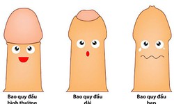 C&#226;u hỏi thường gặp li&#234;n quan đến bệnh hẹp bao quy đầu