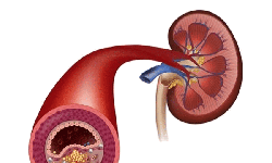 C&#226;u hỏi thường gặp li&#234;n quan đến bệnh hẹp động mạch thận