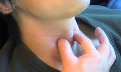 C&#226;u hỏi thường gặp li&#234;n quan đến bệnh liệt cơ mở thanh quản