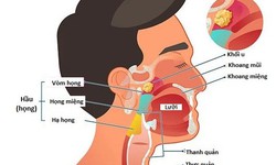 Ung thư đầu v&#224; cổ - Những điều n&#234;n biết