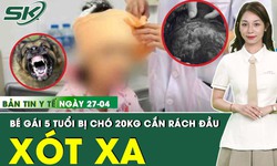 Bản tin Y tế 27/4: B&#233; g&#225;i 5 tuổi bị ch&#243; nh&#224; 20 kg cắn r&#225;ch đầu, mặt 
