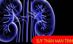 C&#225;c phương ph&#225;p điều trị suy thận mạn t&#237;nh