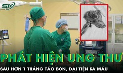 Ph&#225;t hiện ung thư đại tr&#224;ng x&#226;m lấn b&#224;ng quang sau hơn một th&#225;ng t&#225;o b&#243;n, đại tiện ra m&#225;u 