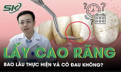 Bao l&#226;u n&#234;n lấy cao răng một lần v&#224; c&#243; đau kh&#244;ng?