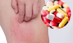 Thuốc dị ứng c&#243; an to&#224;n khi d&#249;ng mỗi ng&#224;y?