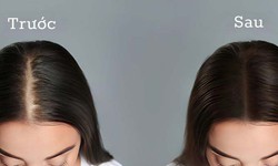 3 c&#225;ch gội đầu giảm rụng t&#243;c