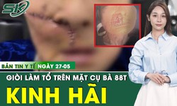 Bản tin Y tế 27/5: Gi&#242;i &#39;l&#224;m tổ&#39; trong khối u tr&#234;n mặt cụ b&#224; 88 tuổi ở Quảng Nam
