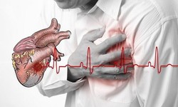C&#225;c yếu tố nguy cơ g&#226;y nhồi m&#225;u cơ tim