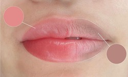 Nguyên nhân khiến môi thâm và cách khắc phục hiệu quả