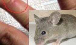 Những bệnh c&#243; thể l&#226;y nhiễm từ chuột v&#224; c&#225;ch ph&#242;ng