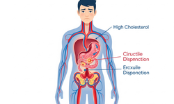 Cholesterol cao c&#243; thể g&#226;y ra rối loạn cương dương?
