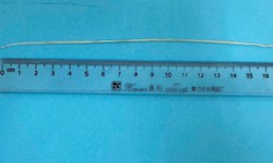 Tưởng chỉ l&#224; sưng tấy, bất ngờ b&#225;c sĩ r&#250;t được giun rồng d&#224;i gần 20 cm từ vết thương