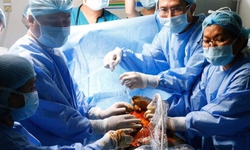 H&#224;nh tr&#236;nh &#237;t người biết về kỳ t&#237;ch can thiệp tim b&#224;o thai ở Việt Nam