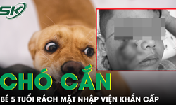B&#233; 5 tuổi bị ch&#243; cắn r&#225;ch mặt, cảnh b&#225;o li&#234;n tiếp nhiều trẻ cấp cứu v&#236; động vật tấn c&#244;ng