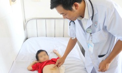 B&#250;i t&#243;c nặng gần nửa c&#226;n nằm trong bụng b&#233; trai 5 tuổi
