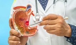 N&#234;n v&#224; kh&#244;ng n&#234;n ăn g&#236; khi bị lo&#233;t dạ d&#224;y?