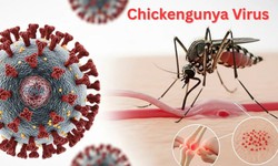 Muỗi đốt truyền bệnh Chikungunya lưu h&#224;nh tại nhiều địa phương, Bộ Y tế n&#243;i g&#236; về nguy cơ dịch bệnh n&#224;y?