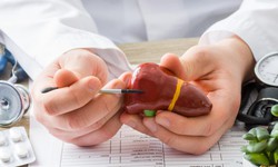 5 nguy&#234;n nh&#226;n phổ biến g&#226;y tăng men gan