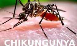 Chikungunya dễ g&#226;y t&#224;n phế v&#224; nhầm lẫn với sốt xuất huyết