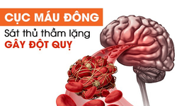5 th&#243;i quen xấu g&#226;y h&#236;nh th&#224;nh cục m&#225;u đ&#244;ng trong l&#242;ng mạch, đe dọa sức khỏe