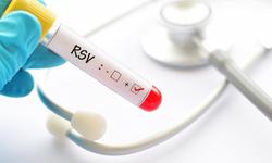 Dự phòng bệnh hô hấp do RSV ở trẻ sơ sinh, chuyên gia sản khoa khuyến cáo gì?
