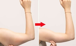 B&#224;i tập n&#224;o gi&#250;p bắp tay thon gọn cho phụ nữ tuổi 40?
