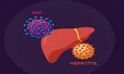 Điều trị đồng nhiễm HIV v&#224; vi&#234;m gan C, gi&#250;p giảm tổn thương gan