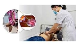 Cứu sống b&#233; g&#225;i 12 tuổi bị vi&#234;m n&#227;o tự miễn