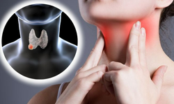 Chuyên gia chỉ cách ổn định nhân tuyến giáp: Không to lên, không biến chứng