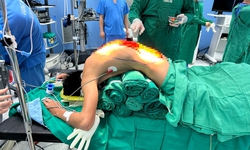 10 giờ phẫu thuật giải cứu người đàn ông 'cong như con tôm' , 7 năm cúi mặt xuống đất