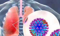 Virus hợp bào hô hấp ở trẻ ủ bệnh bao lâu và cách phòng tránh