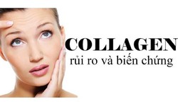 Ai không nên bổ sung collagen?