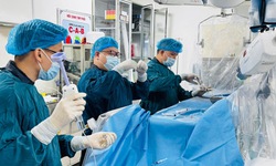 Đột quỵ trẻ hoá, lời cảnh báo của bác sĩ về căn bệnh này