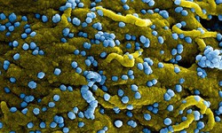 WHO: Ethiopia tuyên bố khống chế được đợt bùng phát virus Marburg