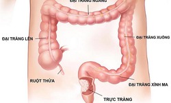 Những lưu ý quan trọng khi nội soi đại tràng, dạ dày bằng gây mê