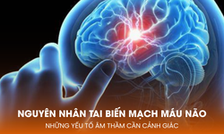 Nguyên nhân tai biến mạch máu não: Những yếu tố âm thầm cần cảnh giác