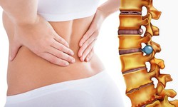 Thoát vị đĩa đệm khi nào cần phẫu thuật?