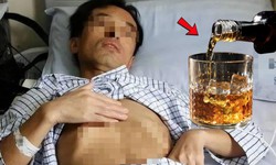 Người đàn ông 53 tuổi mắc ung thư gan, 'thủ phạm' là thói quen phổ biến